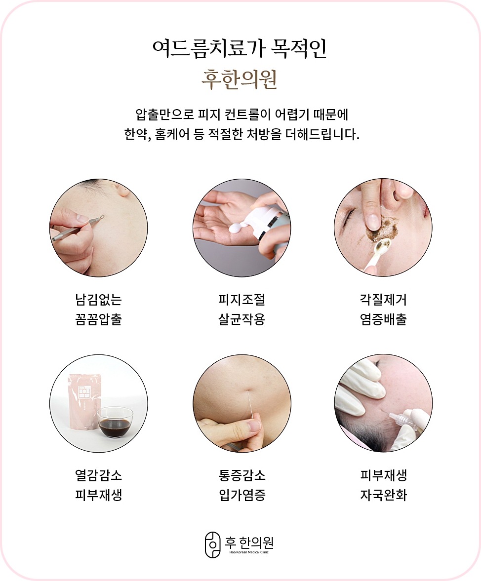 구미여드름한의원 후한의원 치료 단계 이미지 설명