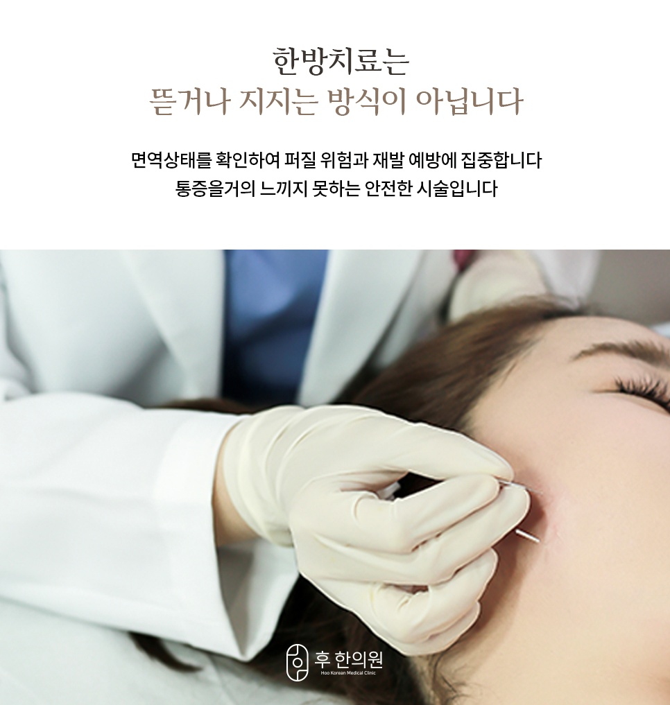 한의원의 편평사마귀 침 치료 시술 모습