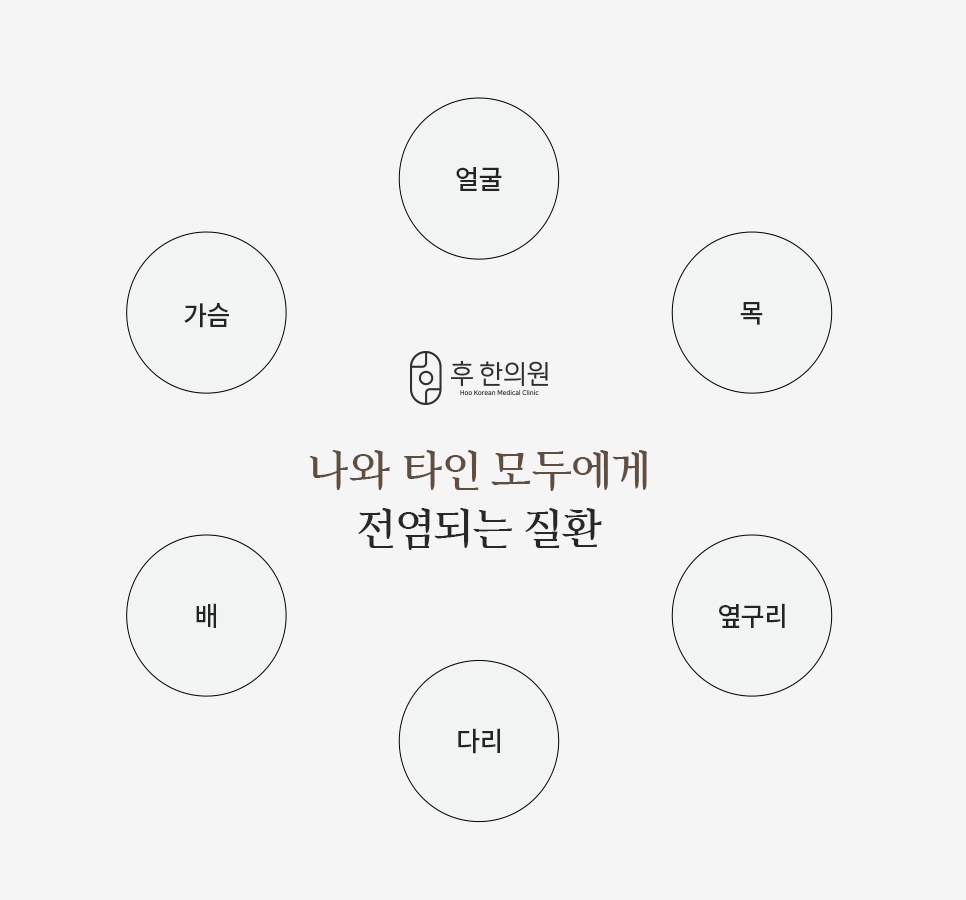 편평사마귀 전염 가능 부위 안내