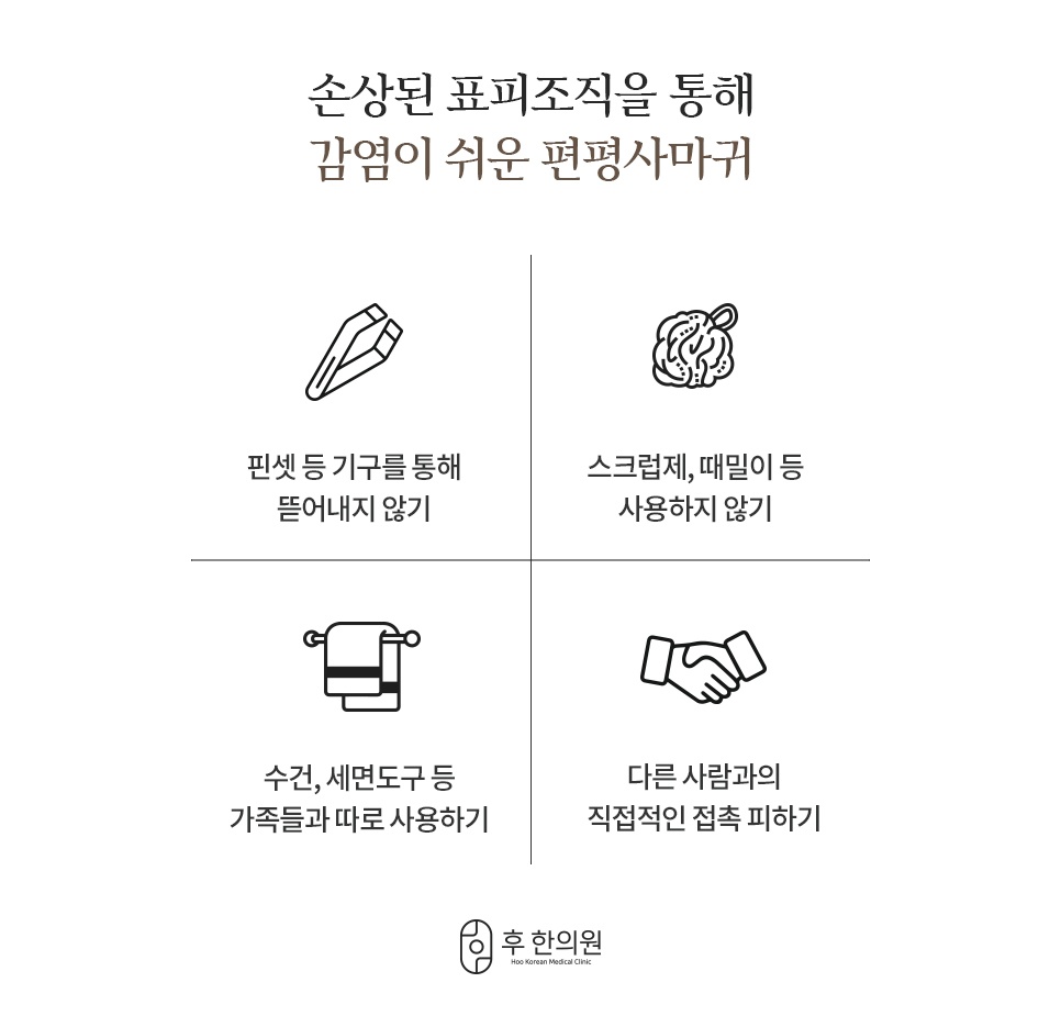 편평사마귀 전염을 막기 위한 일상 속 주의사항