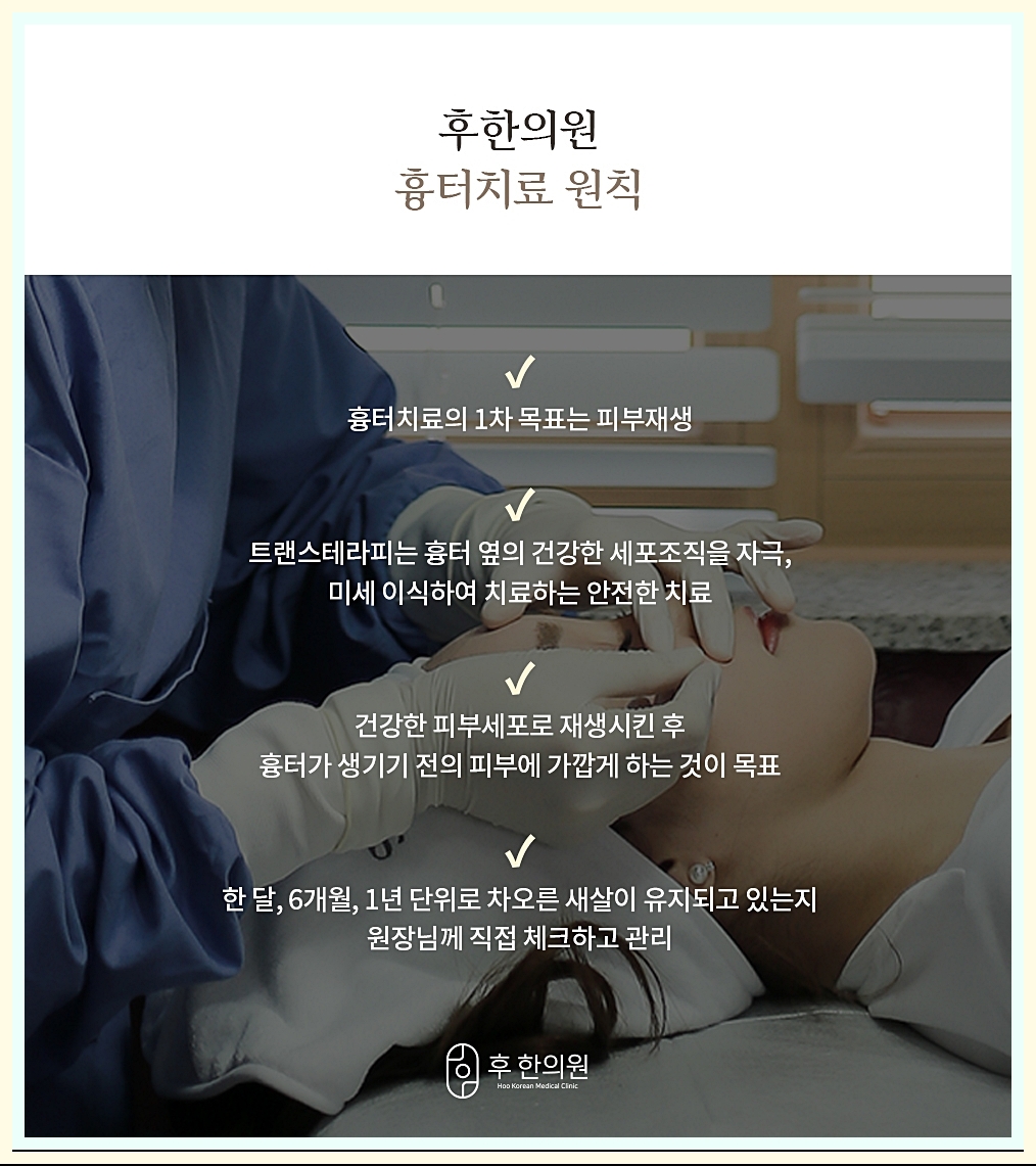 구미여드름흉터 치료의 원칙