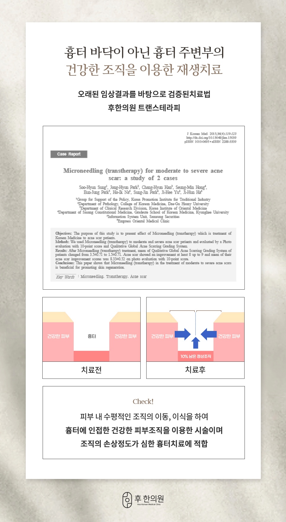 후한의원 트랜스테라피 여드름흉터 주변부 정상조직 이용 재생치료 원리