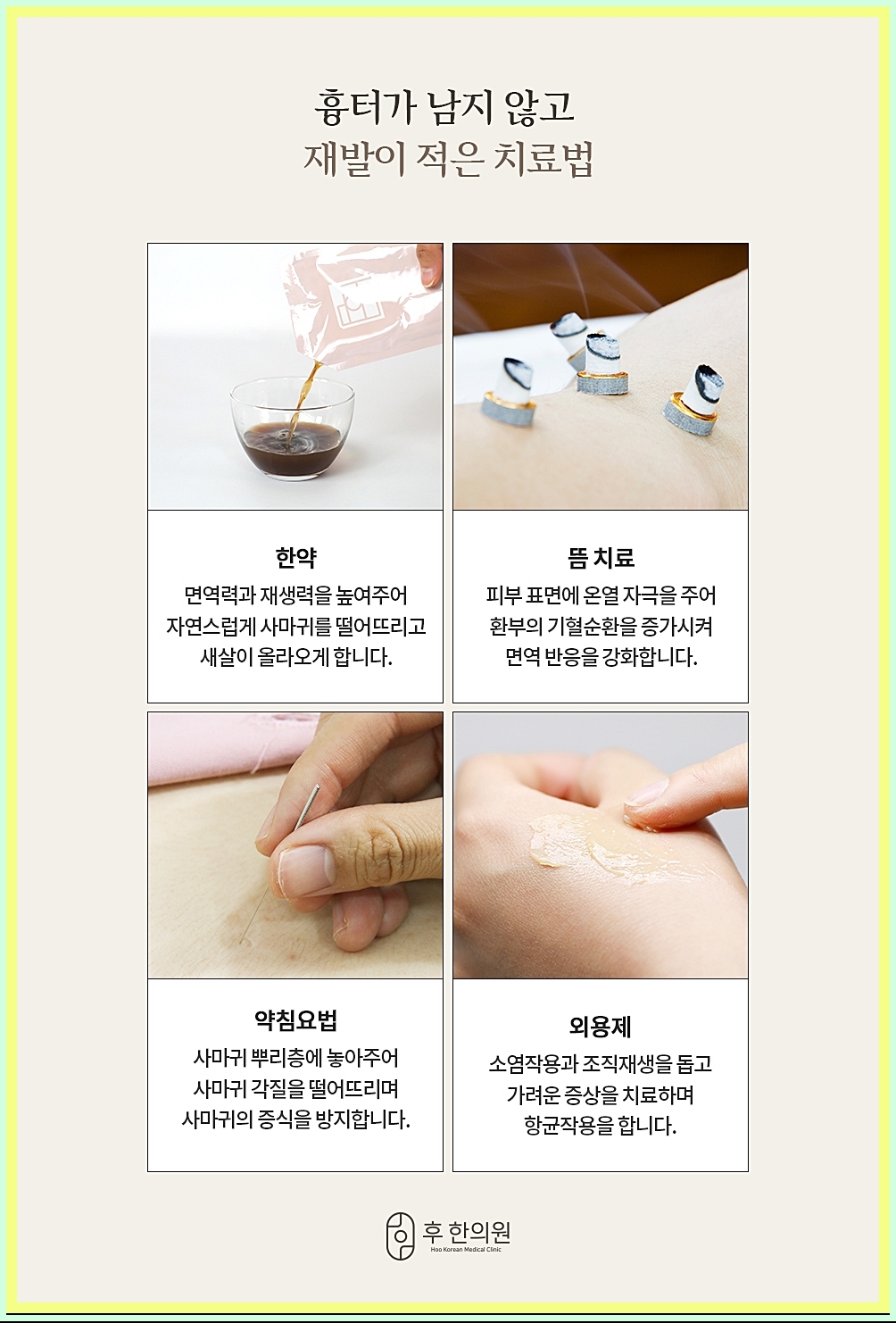다양한 사마귀 치료 방법