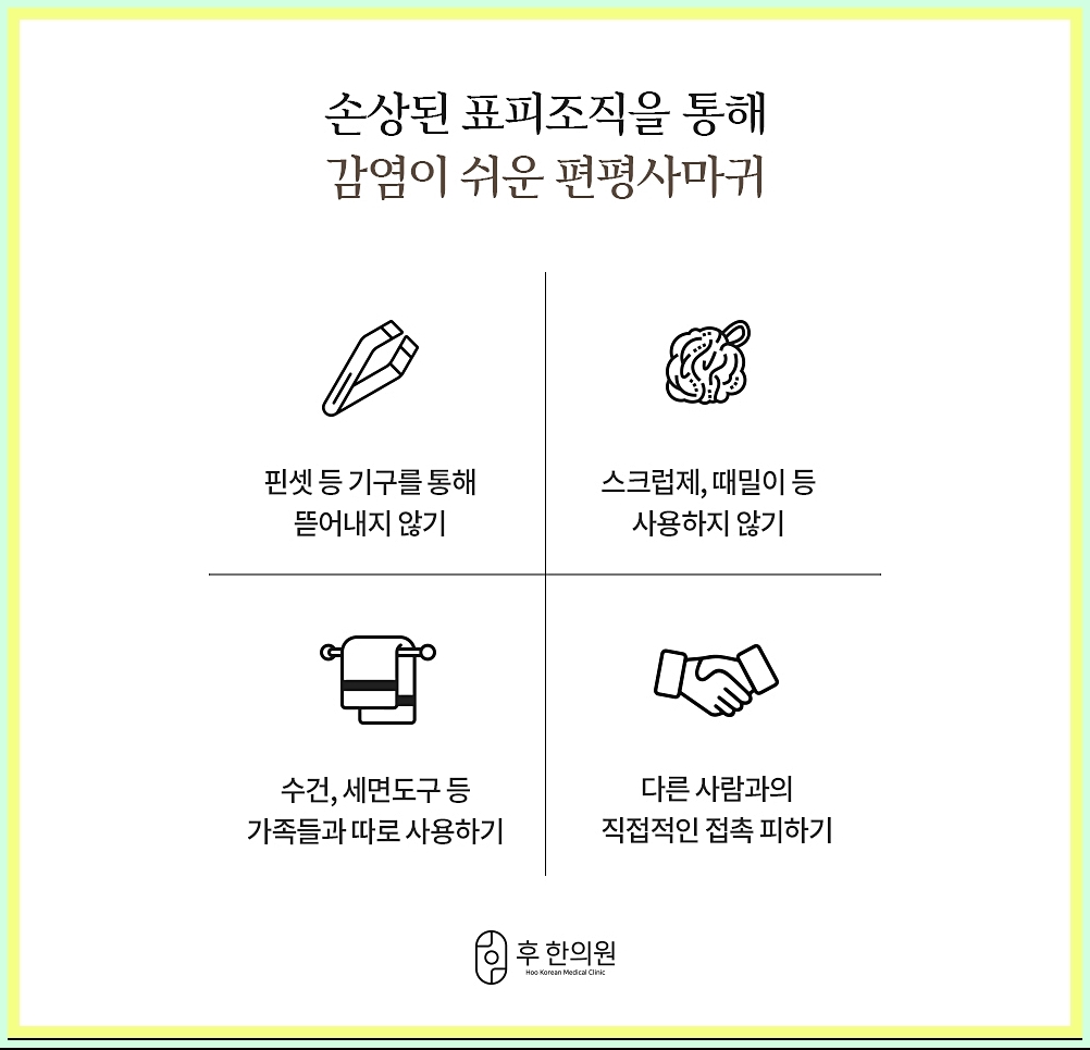 일상속 사마귀 관리