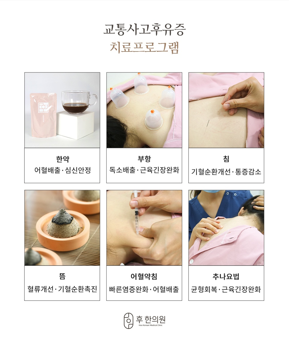 한약·부항·침·뜸·어혈약침·추나요법 6가지로 구성한 후유증 치료프로그램