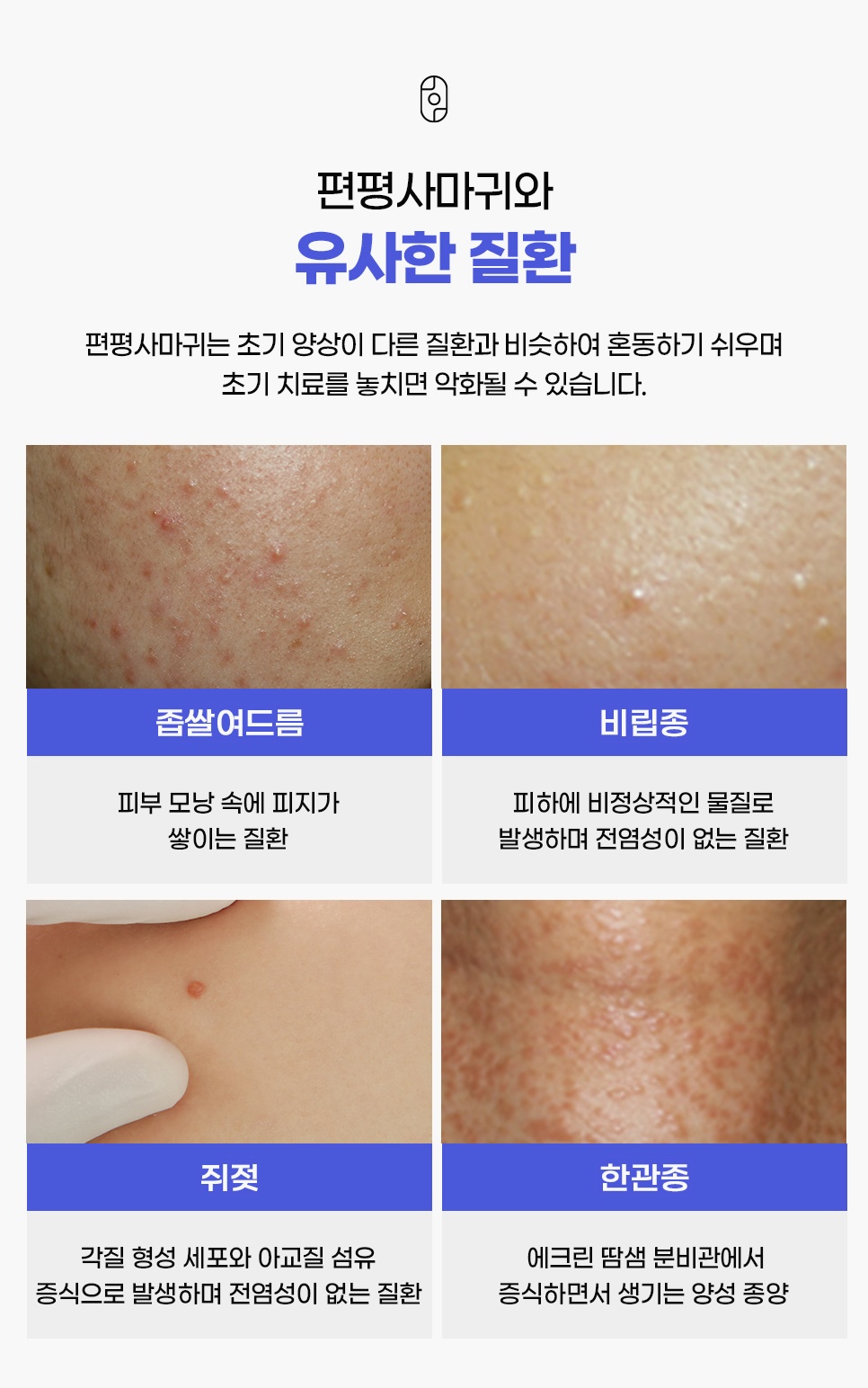 좁쌀여드름·비립종·쥐젖·한관종과 혼동하기 쉬운 편평사마귀 유사 질환 비교