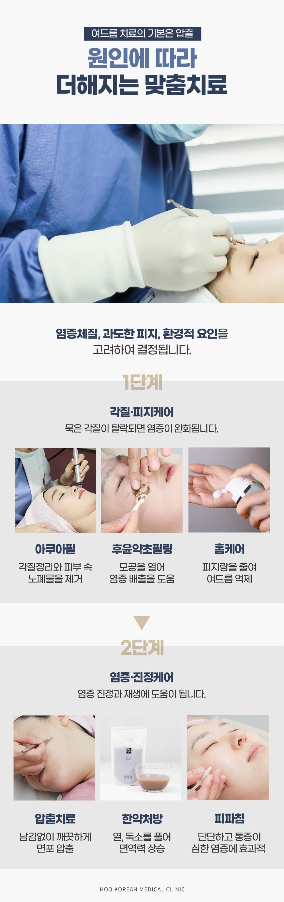아쿠아필·후윤약초필링·홈케어의 1단계와 압출·한약처방·피파침의 2단계로 이어지는 원인별 맞춤치료
