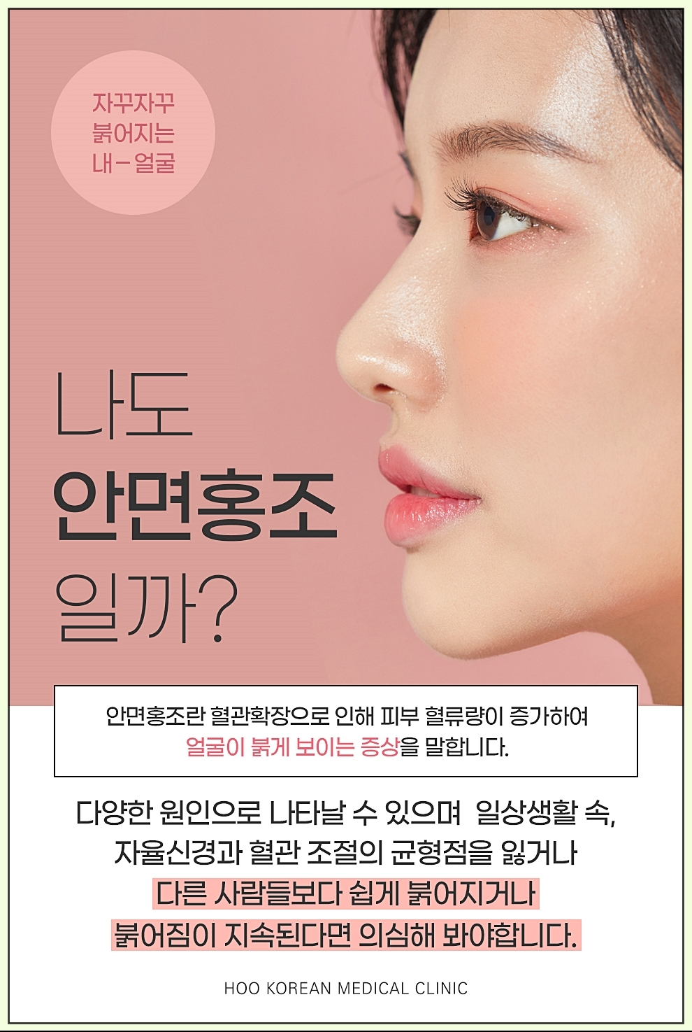 안면홍조의 정의에 대한 이미지