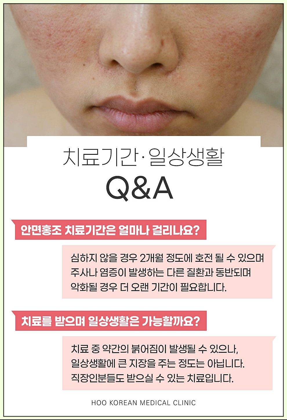 구미안면홍조 큐앤에이